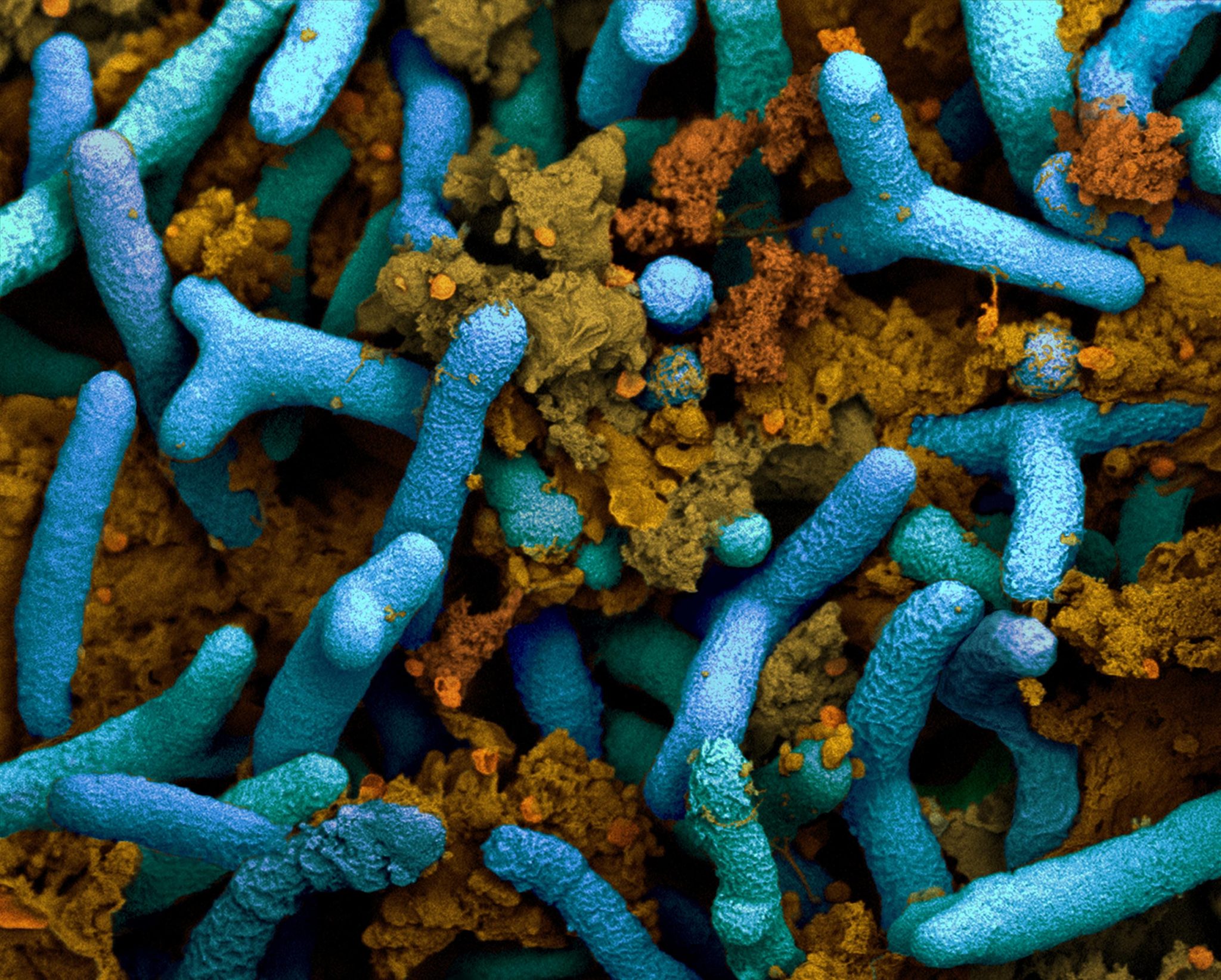 Биология – бактерии: виды, названия, вредные и полезные для жизни человека, численность, формы